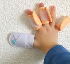 a hand with bandages on it holding an object