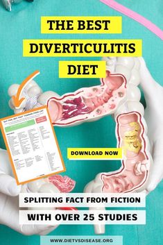 Do you have diverticulitis? Read the last article where I explain what is diverticulitis diet, how to treat flare up, adjust your medication and supplements, foods to avoid and so much more! I also answer if you should do FODMAP diet and give your a sample recipe meal plan that you can print out as your grocery shopping list. Dietitian Nutrition Science Education Facts | Simple Diet Plan Menu Ideas | Symptoms Healthy Living | Holistic Health And Fitness | Health Coach Nutritionist Tips Website Nutrition Science, Easy Diet Plan, Best Diet, Food Intolerance, Fodmap Diet, Diet Menu, Nutrition Education, Foods To Avoid