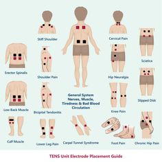 Lower Leg Pain, Cervical Pain, Muscle Knots, Tens Ems