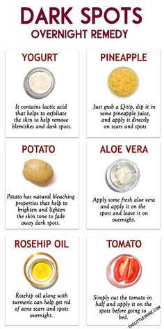 Skin Care For Sunspots, How To Clear Dark Spots On Face Overnight, Dark Spot On Face Remedies, Homemade Skin Care For Dark Spots, Dark Spots On Back From Acne, Sunspots On Face Remedies, Diy For Dark Spots On Face, Diy Skin Lightener Dark Spots, Diy Face Mask For Dark Spots