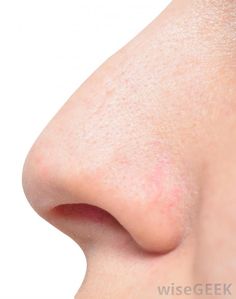 a woman's nose with acne on it and the tip of her nose