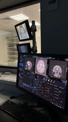 a computer screen showing mri images in an office cubicle with computers on the desk