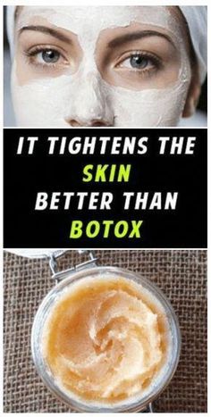 Homemade Wrinkle Cream, Lotion For Oily Skin, Tips For Oily Skin, Tighten Skin, Baking Soda Shampoo, Moisturizer For Oily Skin, Face Wrinkles, Wrinkled Skin, Homemade Face