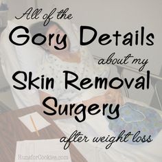 Excess Skin Removal Surgery, Thigh Lift Surgery Before And After, Lower Body Lift Surgery Before And After, Skin Removal Surgery Before And After, Lower Body Lift Surgery, Panniculectomy Before And After