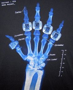 an x - ray image of a skeleton hand with different parts labeled in blue ink