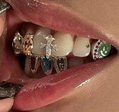 a close up of a person's mouth with many different rings on the teeth