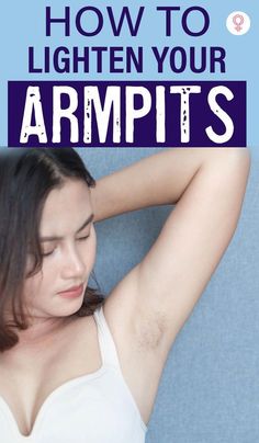 Dark, smelly armpits are such a turn-off. And because the armpit area has extremely sensitive skin, the problem becomes graver. To top it all, Whiten Underarms Fast, Smelly Armpits, Armpit Odor, How To Whiten Underarms, Stretch Mark Removal, Stretch Mark