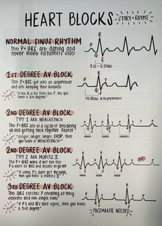 a poster with instructions on how to use heart blocks for cardiogramic purposes