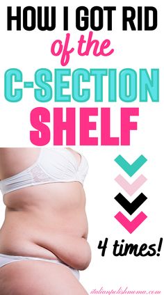 A new mom trying to get rid of her c-section shelf or c-section apron belly and tips to lose it fast. Exercises For Tummy Pooch, Belly Overhang Before And After, Belly Overhang Get Rid Of, Get Rid Of Csection Pouch Ab Workouts, Getting Rid Of Tummy Pooch Lower Belly, How To Get Rid Of Csection Pooch, Yoga For C Section Recovery, How To Tighten Loose Skin On Stomach After C Section, Lose C Section Pouch