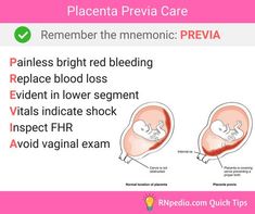 a diagram showing the stages of breasting and how to prevent them from being pregnant