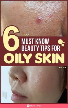 Beauty Tips For Oily Skin, Lotion For Oily Skin, Tips For Oily Skin, Oily Face, Moisturizer For Oily Skin, Oily Skin Care, Skin Skincare