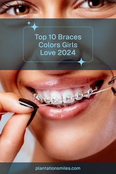 Braces Colors, 10 Things, Color