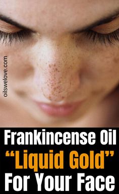 Frankincense oil is a hit in natural beauty care. This essential oil has plenty of practical beauty benefits - most importantly it is powerful anti wrinkle agent. Frankincense Essential Oil Benefits, Frankincense Essential Oil Uses, Essential Oils For Face, Essential Oil Beauty, Essential Oil Diffuser Blends Recipes, Natural Beauty Care, Essential Oils Guide, Essential Oils Herbs, Essential Oils Health