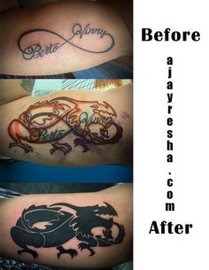 before and after photos of tattoo removals on the arm, from left to right