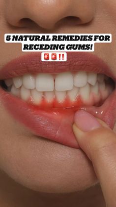 Healthy Mouth, Swollen Gum, Dental Cavities, Health Improvement, Loose Tooth, Whiten Your Teeth, Tooth Sensitivity, Oral Care Routine, Receding Gums