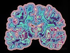 an image of the human brain in blue, pink and green colors - stock photo