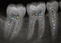 Arte Glitter, Teeth Aesthetic, Dental Aesthetics, Teeth Art, Dentistry Student, Glitter Photography, Dental Marketing, Dental Art, Dental Student