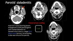 an mri scan shows the different areas of the brain