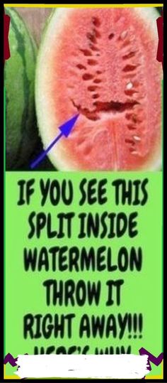 DO YOU LOVE WATERMELONS?? IF YOU SEE THIS SPLIT INSIDE WATERMELON THROW IT RIGHT AWAY!!! Medicine Book, Natural Health Tips, Homemade Remedies, Diet Keto, Natural Treatments, Natural Medicine, Health Awareness, Herbal Medicine, Diet Tips