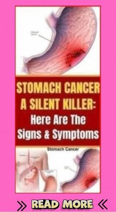 Silent Killer, Healthy Facts, Health Signs, Women Health Care, Preventative Health, Daily Health Tips, Natural Health Tips, Signs And Symptoms, Health Articles