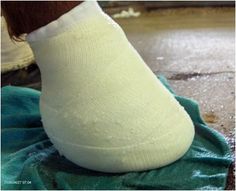 a close up of a person's foot with a cast on it, sitting on the ground