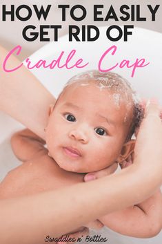 a baby in a bathtub with the title how to easily get rid of cradle cap