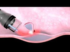 an illustration of a pink liquid pouring out of a bottle into the air with light coming from it