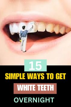 Click the link to discover the best overnight method to whiten your teeth. #teethwhitening #whiteteeth #whitesmile How To Get White Teeth In One Day, How To Get White Teeth Over Night, White Teeth Overnight, White Teeth Tips, Tips On Making Your Teeth White, Toothache Relief, White Teeth Coconut Oil, Teeth Tips, Baking Soda Teeth Whitening