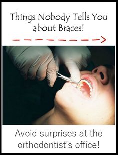 Parenting Tips For Teenagers: Take a look at things nobody tells you about what it's really like to get braces! You Will Be Surprised Invisible Teeth Braces, Orthodontist Office, Braces Cost, Getting Braces, Invisible Braces, Teeth Whitening Diy