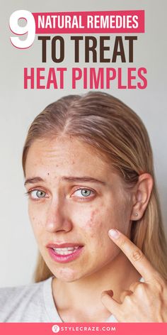 The red, sweat rash-like pimple that appears on your face can be due to the internal heat of your body, and it is known as heat pimples.. It often occurs right on your cheeks or forehead, making you conscious about it. If you are wondering how to get rid of heat pimples, we have the answer.