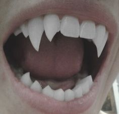 a close up of a person's mouth with teeth missing