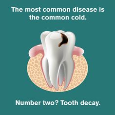 IF YOU DIDN'T know, tooth decay is actually the #2 most common disease in the world! ?That's why we stress the importance of properly taking care of your teeth! #ToothDecay #disease #DidYouKnow Dentist Content, Hygienist Humor, Dental Hygienist Humor