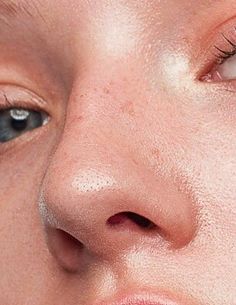 a woman's face with freckles on her cheeks and eyes, close up