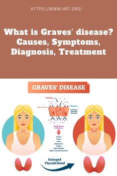 What Is Graves Disease, Diet For Graves Disease, Enlarged Thyroid