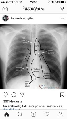 an x - ray shows the location of the chest and ribs in someone's stomach