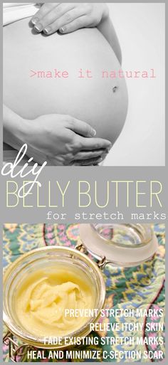 Body Butter For Pregnant Women, Homemade Stretch Mark Cream, Doterra Stretch Mark Blend, Belly Butter Pregnancy Diy, Diy Stretch Mark Oil, Diy Belly Butter, Stretch Mark Cream Pregnancy, Stretch Mark Prevention, Stretch Mark Oil