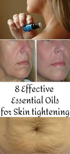 Skin Tightening Essential Oil, For Skin Tightening, Essential Oils Health, Essential Oils For Skin, Skin Care Wrinkles, Saggy Skin, Skin Aging, Skin Care Remedies, Skin Care Recipes