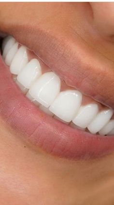 Crest 3d White, Whiter Teeth, Whiten Your Teeth, روتين العناية بالبشرة, Whitening Kit, Teeth Whitening Kit