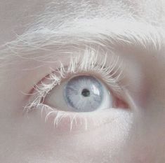 an eye with white hair and blue eyes is shown in this close up photo from the bottom