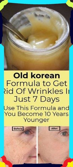 Natural Healing Remedies, Diy Remedies, Natural Therapy, Natural Cream, Wrinkle Cream, Natural Home Remedies, Years Younger