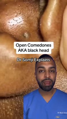 Dr. Somji, a renowned cosmetic surgeon and co-founder of the award-winning DrMediSpa, has spearheaded aesthetic enhancement for over a decade. His commitment... Co Founder, Award Winning