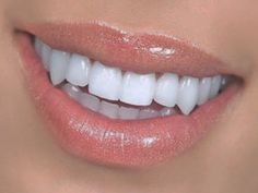 Vampire Teeth Body Mod, Perfect Teeth With Fangs, Permanent Fangs, Natural Vampire Teeth, Straight White Teeth, Small Fangs, Types Of Smiles, Sharpened Teeth