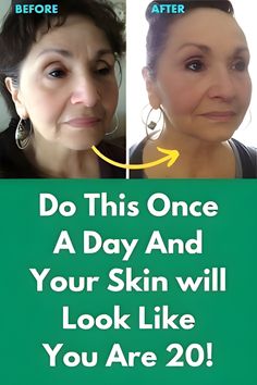 Look like 20 by doing this to your skin daily Diy Facial Moisturizer, Diy Anti Aging, Diy Facial, Remove Dark Spots