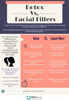 Botox vs. Dermal fillers : Botox vs. Dermal fillers : Few important differences between Botox and Dermal fillers, which will help you to choose the best of them according to your needs !! http://visual.ly/botox-vs-dermal-fillers Facial Fillers, Facial Aesthetics, Botox Fillers, Info Graphic, Botox Injections