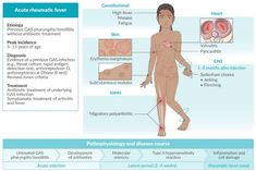 Brief overview of acute rheumatic fever Hospital Medicine, High Fever, Medical Knowledge, Sore Throat, Pediatrics, Disease, Medicine, Medical