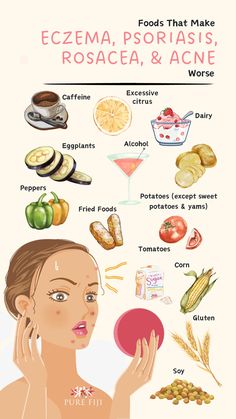 Eating too many inflammatory foods may cause chronic low-grade inflammation. For many the most common symptoms are unsightly skin eruptions like; eczema, psoriasis, rosacea, and cystic acne flare-ups. Did you know that your diet and environmental aggressors play a role in how reactive our skin can get? Do your best to cut back on these foods. Low Inflammatory Foods, Psoriatic Skin Diet, Psoriatic Skin Remedies, Skin Allergy Remedies, Skincare Topics, Tips For Sensitive Skin, Moisturizers For Dry Skin, Acne Reasons, Forehead Acne