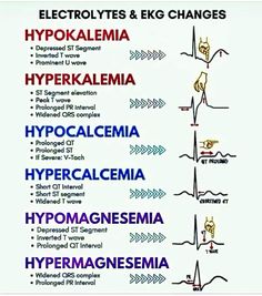 Paramedic Motivation, Er Medicine, Paramedic Tips, Ekg Rhythms, Paramedic School