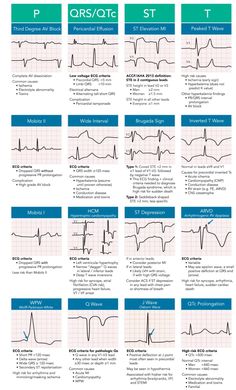 Cardiology Nursing, Paramedic School, Nursing School Essential, Nurse Study Notes, Nursing Student Tips, Cardiac Nursing, Nursing School Survival, Critical Care Nursing, Nursing School Studying