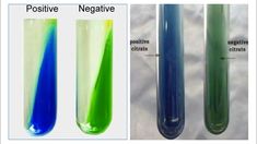 Bacterial Citrate Test Medical Laboratory Science, Nursing School Survival, Medical Anatomy, Sodium Citrate, Medical Laboratory, Laboratory Science, School Survival, Bullet Journal Art