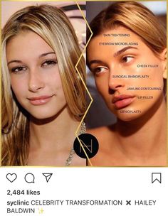 Kylie Jenner Plastic Surgery, Cosmetic Fillers, Celebrity Instagram